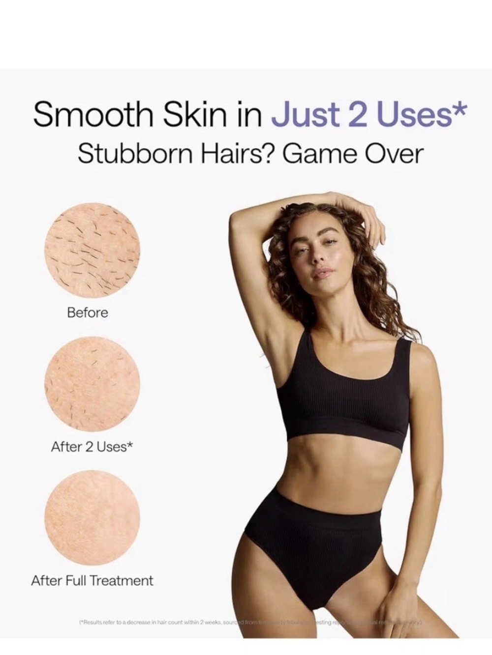 Ulike Air 10Purple IPL Hair Removal Device - Picture 2 of 8